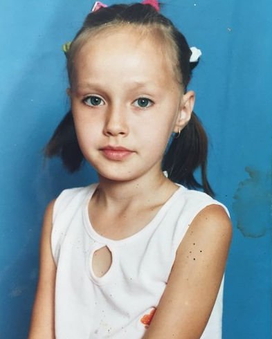 Анастасия Костенко подверглась пластической операции