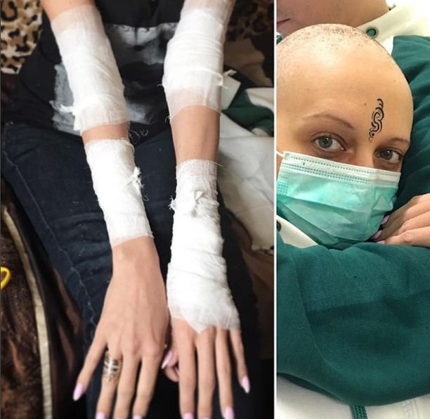 Пытаясь оправиться от рака, певица Лама Сафонова испытывает мучительные боли