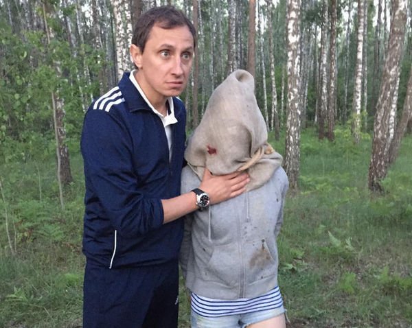 Вадим Галыгин удивил фотографией с обезображенным лицом