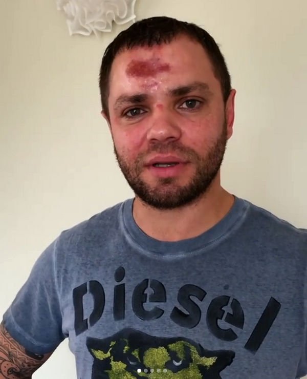 Роман Пашков из группы "Градусы" чудом не получил серьезных повреждений в аварии