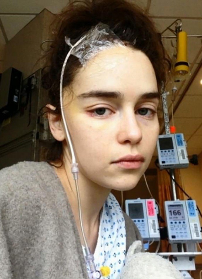 Эмилия Кларк ужаснула рассказом об операциях и инсульте и показала фото из больницы
