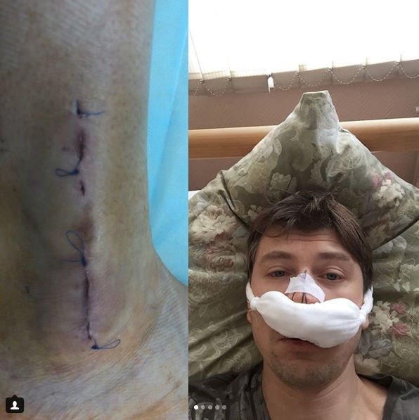 Алексей Ягудин поделился фотографией из больницы