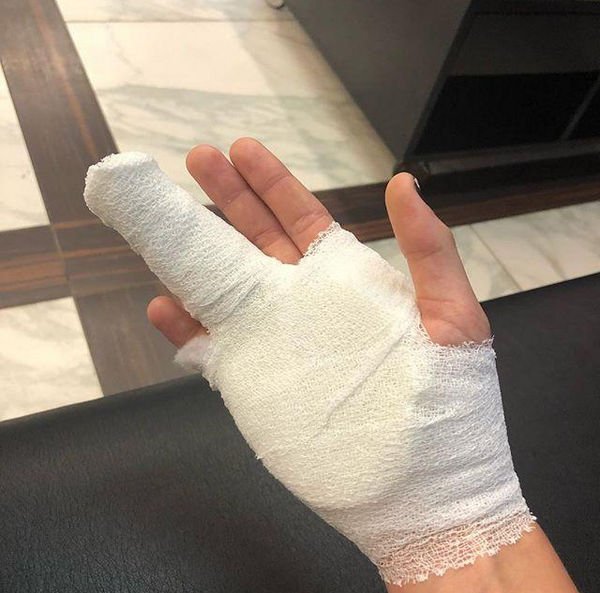 Дочь Анастасии Волочковой сломала руку во время занятий спортом