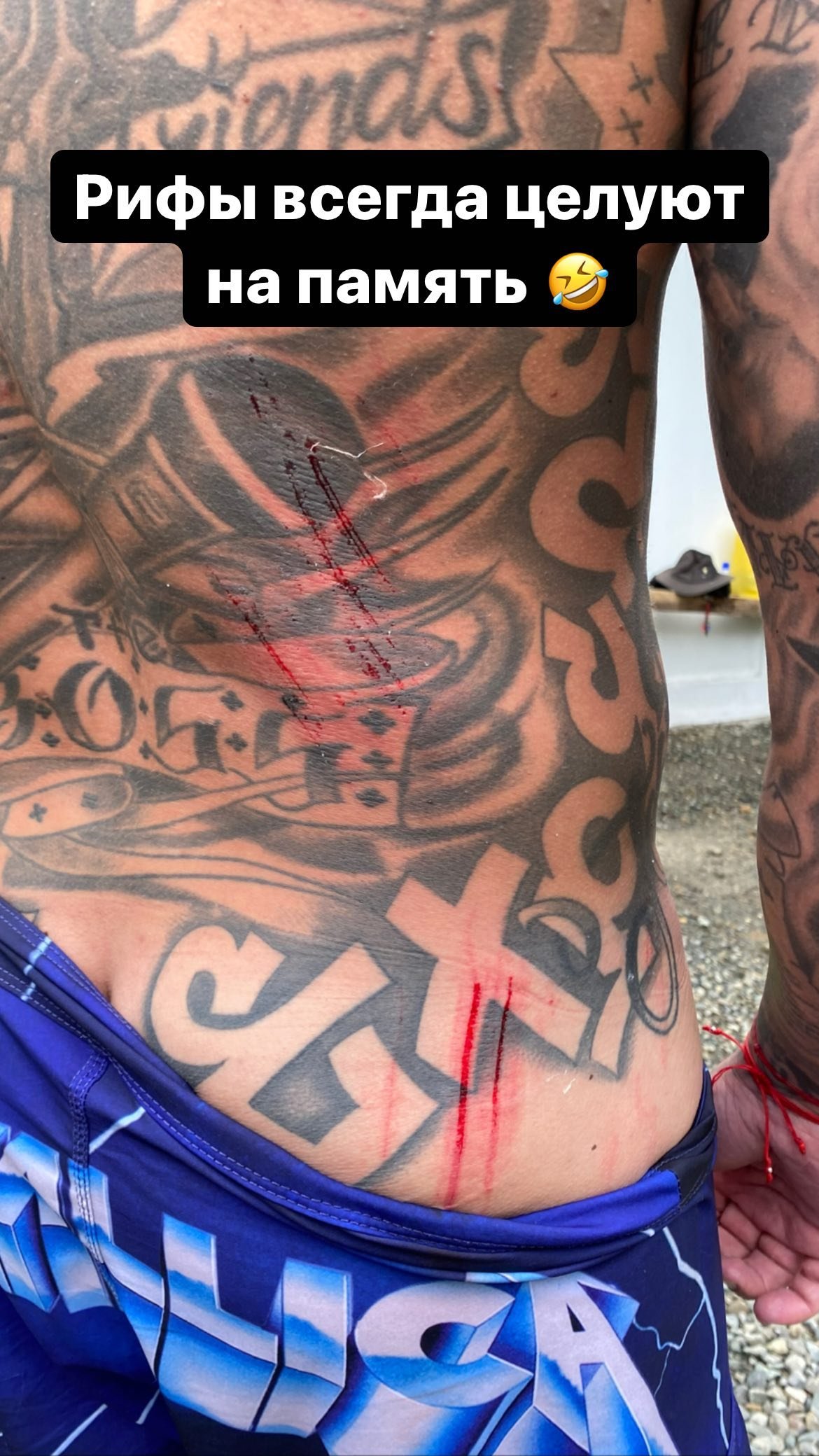 Рэпер Тимати показал раны на спине после сёрфинга 