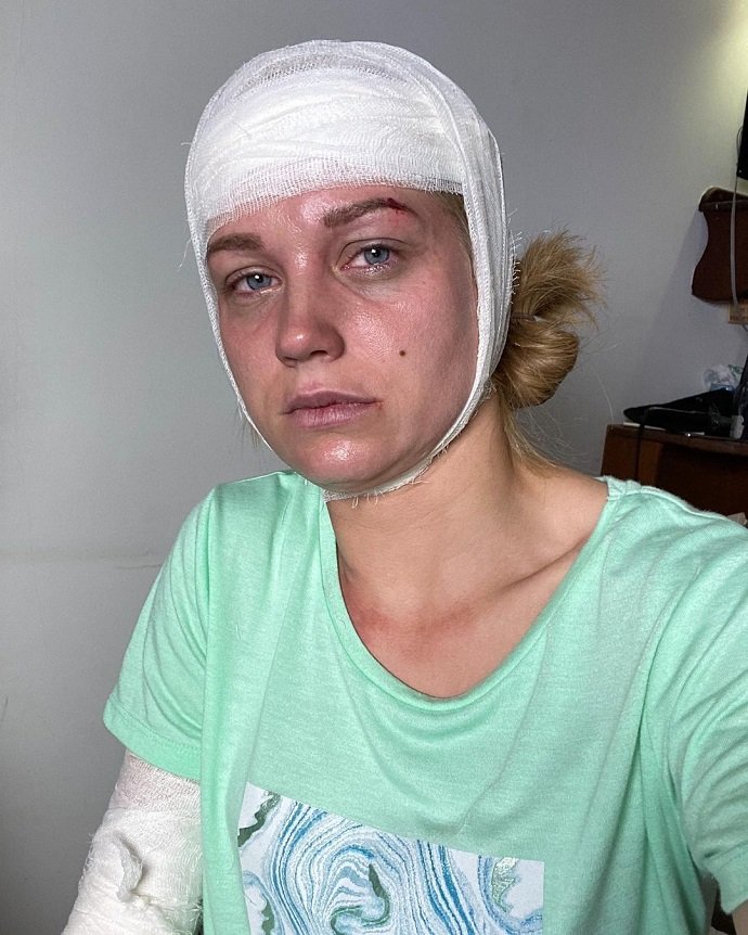 Кристина Асмус опубликовала фото с перебинтованной головой: что случилось с актрисой