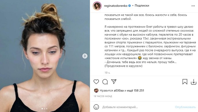 Регина Тодоренко вернулась в Инстаграм и рассказала о проблемах со здоровьем