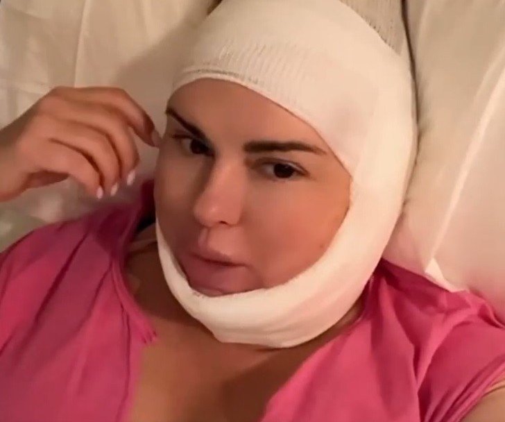 Анна Семенович сделала пластическую операцию