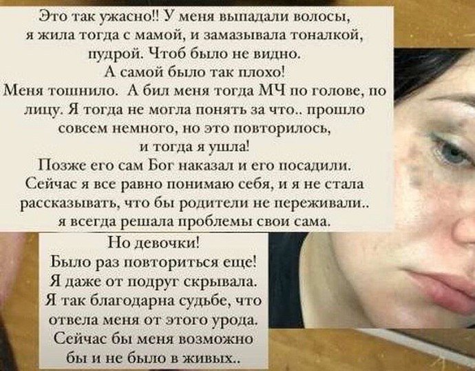 Дочь продюсера Иосифа Пригожина Даная показала лицо после жестокого избиения