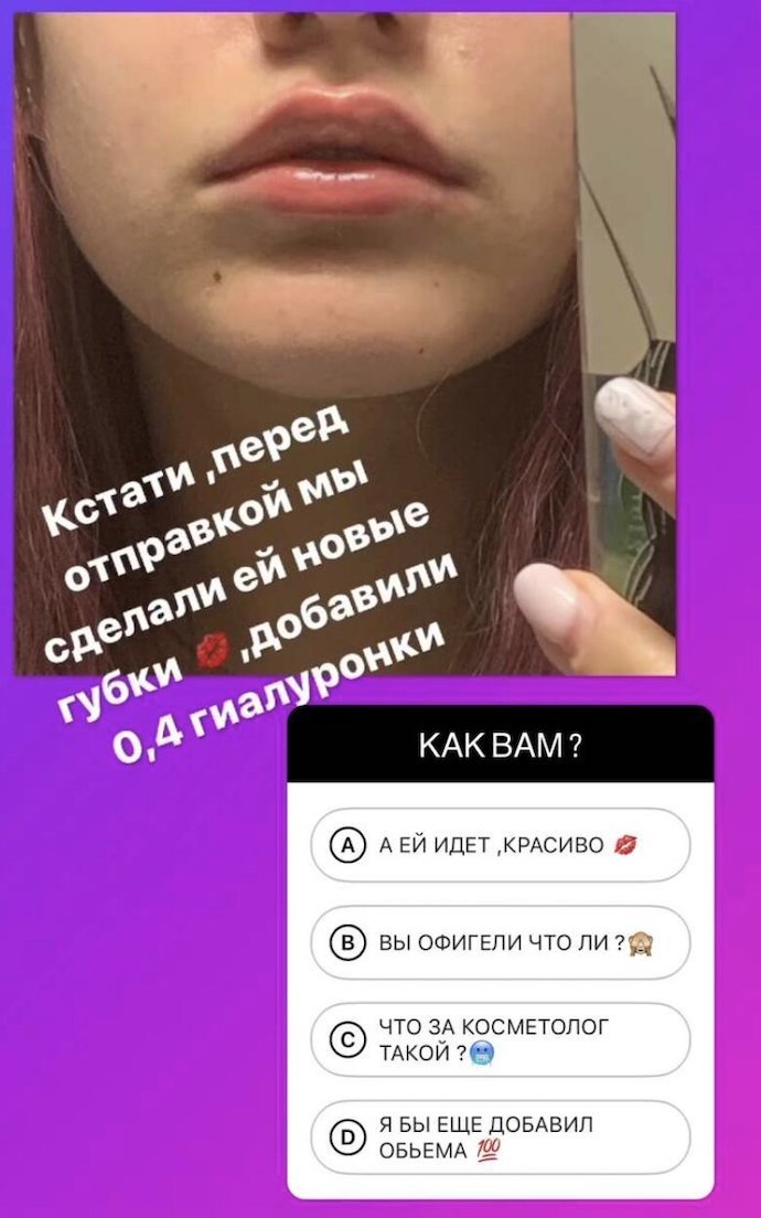 Дана Борисова попросила подписчиков оценить «новые» губы своей 15-летней дочери 