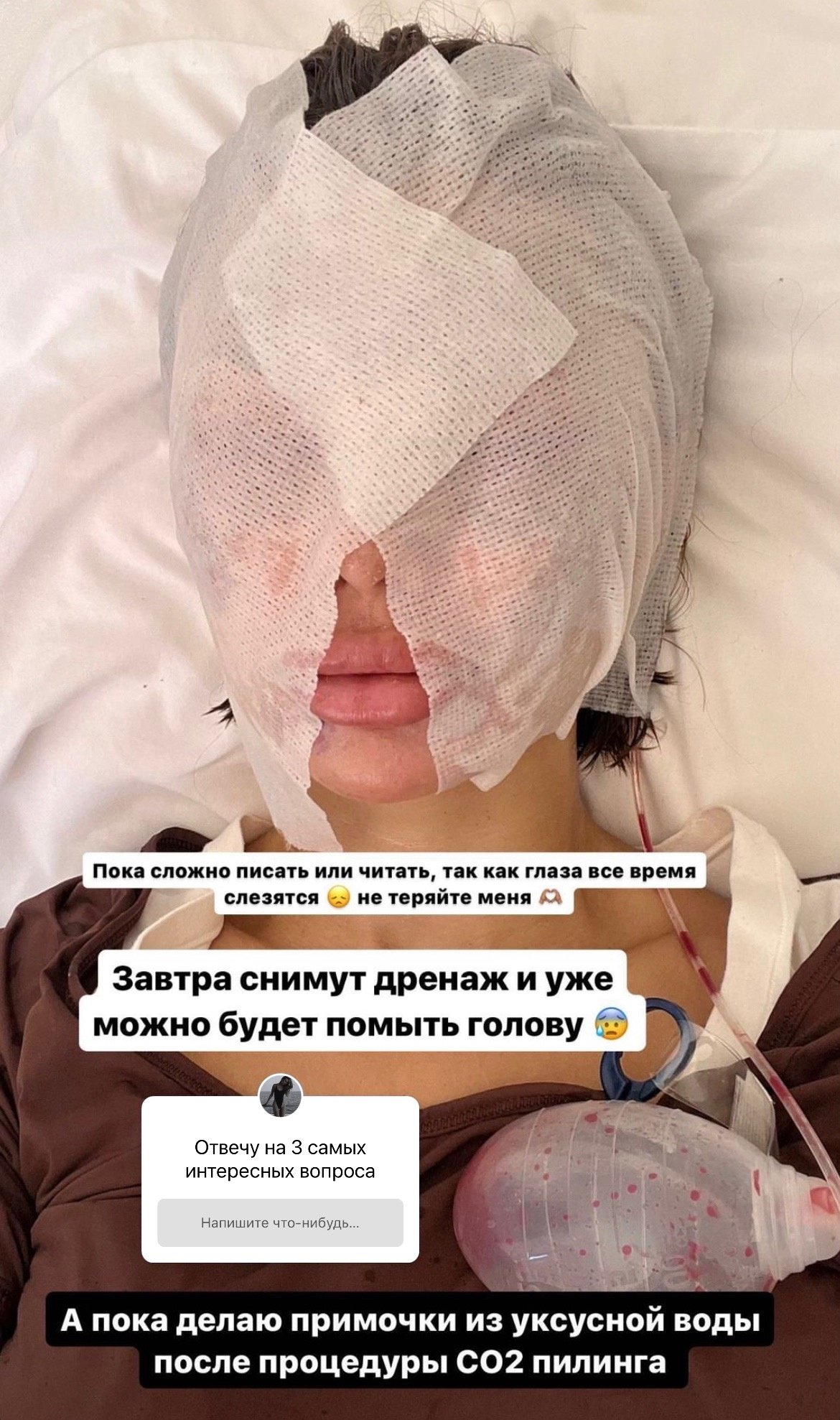 "Не хватает рук": Виктория Боня ответила на критику после пластической операции