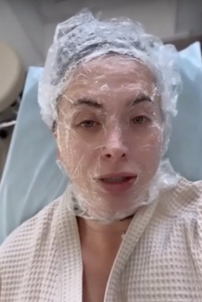 Наталья Фриске показала свое лицо после посещения косметолога
