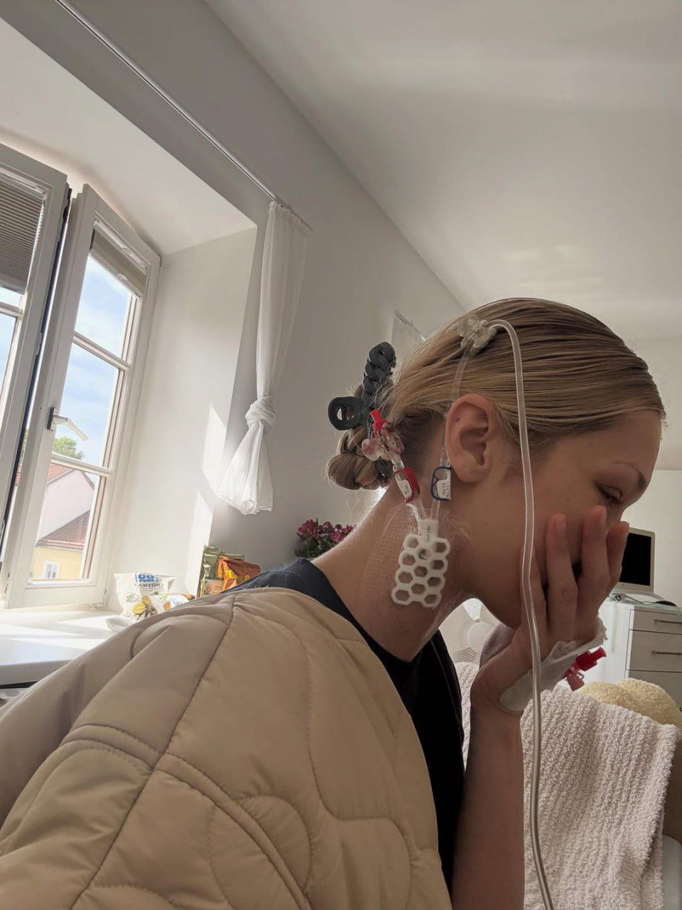 У бедняжки Беллы Хадид снова обострилась ее хроническая болезнь Лайма