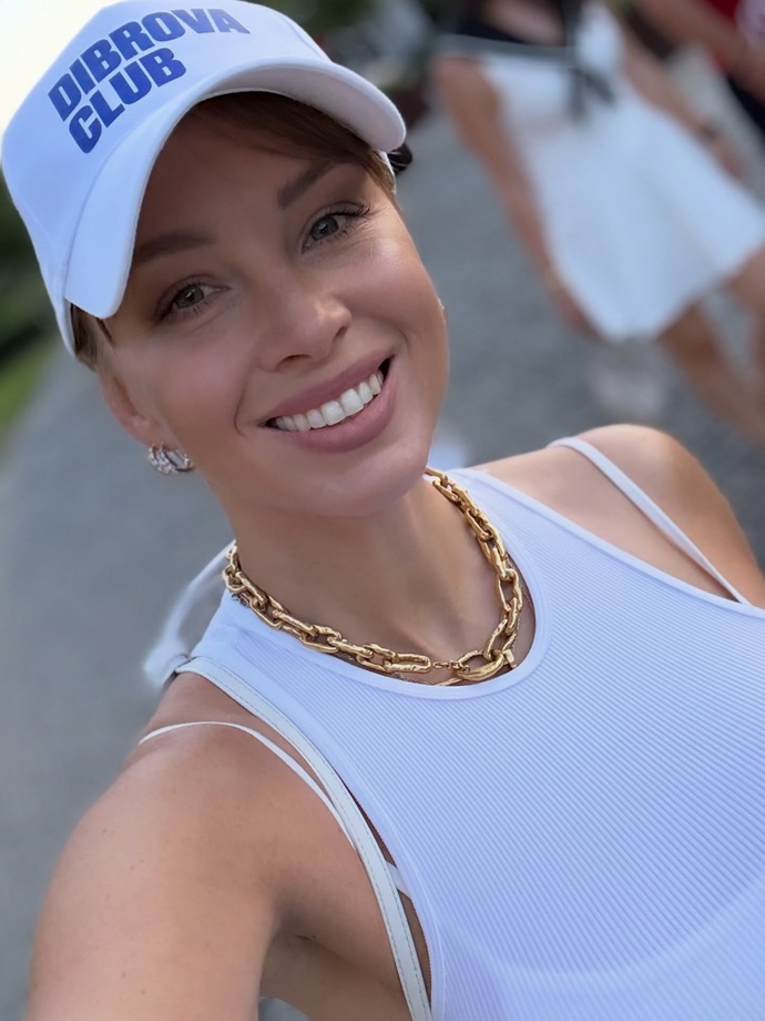 Откуда у Полины Дибровой появились синяки и ссадины на лице Откуда у Полины Дибровой появились синяки и ссадины на лице